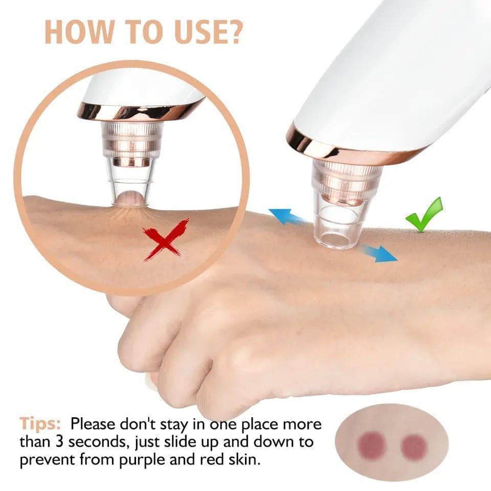 pore cleaner
